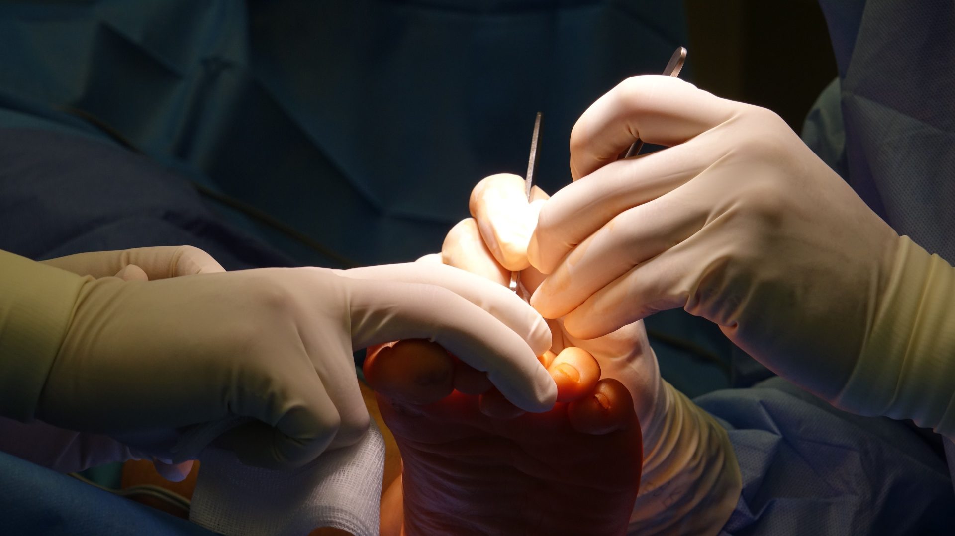 Gloved hands performing intricate foot surgery in a sterile operating environment.